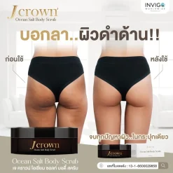 J CROWN เจคราวน์ บอดี้ สครับขัดผิวจากธรรมชาติ ด้วยสารสกัดพรีเมี่ยม 11 ชนิด