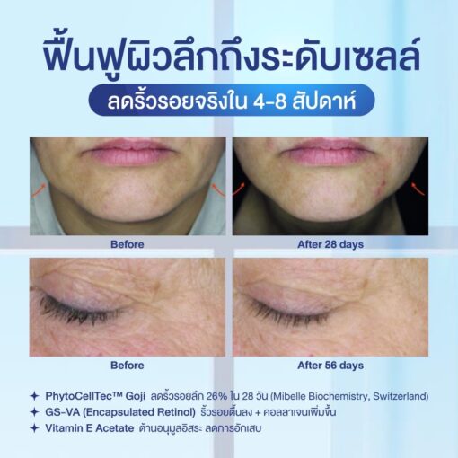 BONETA EXOGLOW ผิวชุ่มชื่น ลดรอยหมองคล้ำ ฟื้นฟูเซลล์ผิว - Image 8