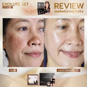 Reviwe EXOLUTE Set ชุดหน้าเด็ก ดูแลผิวหน้า เอ็กโซลูทเซ็ท