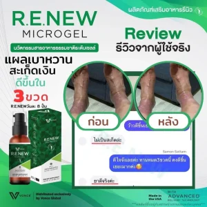 Review R.W.New รีวิววีนิว