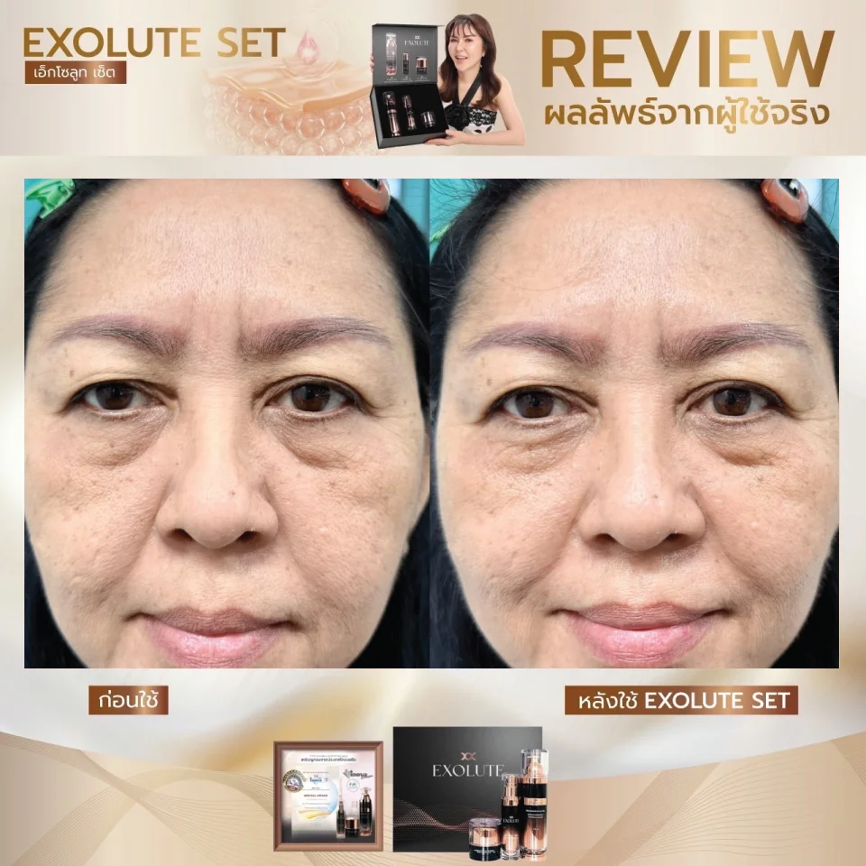 Review EXOLUTE-SKIN เอ็กโซลูท คอมเพล็กซ์ มัลติ เซรั่ม
